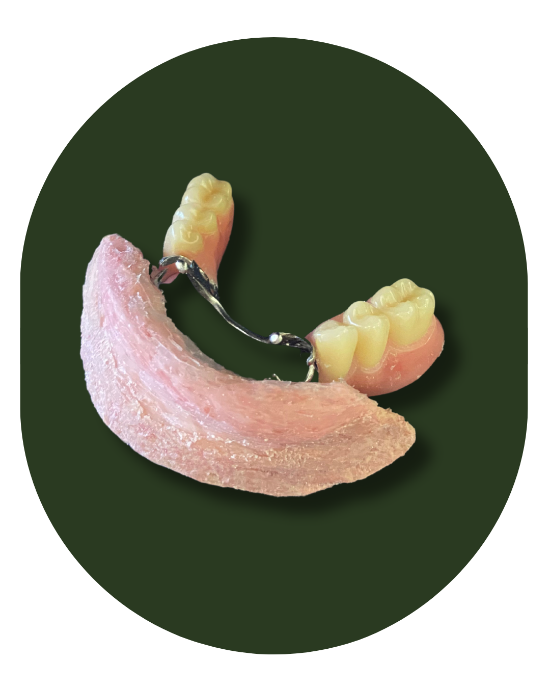 protese bucomaxilofacial, intra oral, Obturadora, Prótese para grandes perdas de maxila ou mandíbula, Rebaixadora de palato, Obturadora Imediata, Óculo Palpebral, Ocular, Nasal, Prótese de orelha, Prótese labial, Facial extensa, PROTETORES PARA RADIOTERAPIA