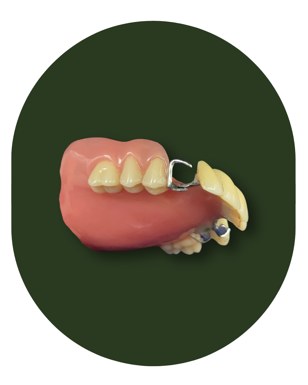 protese bucomaxilofacial, intra oral, Obturadora, Prótese para grandes perdas de maxila ou mandíbula, Rebaixadora de palato, Obturadora Imediata, Óculo Palpebral, Ocular, Nasal, Prótese de orelha, Prótese labial, Facial extensa, PROTETORES PARA RADIOTERAPIA