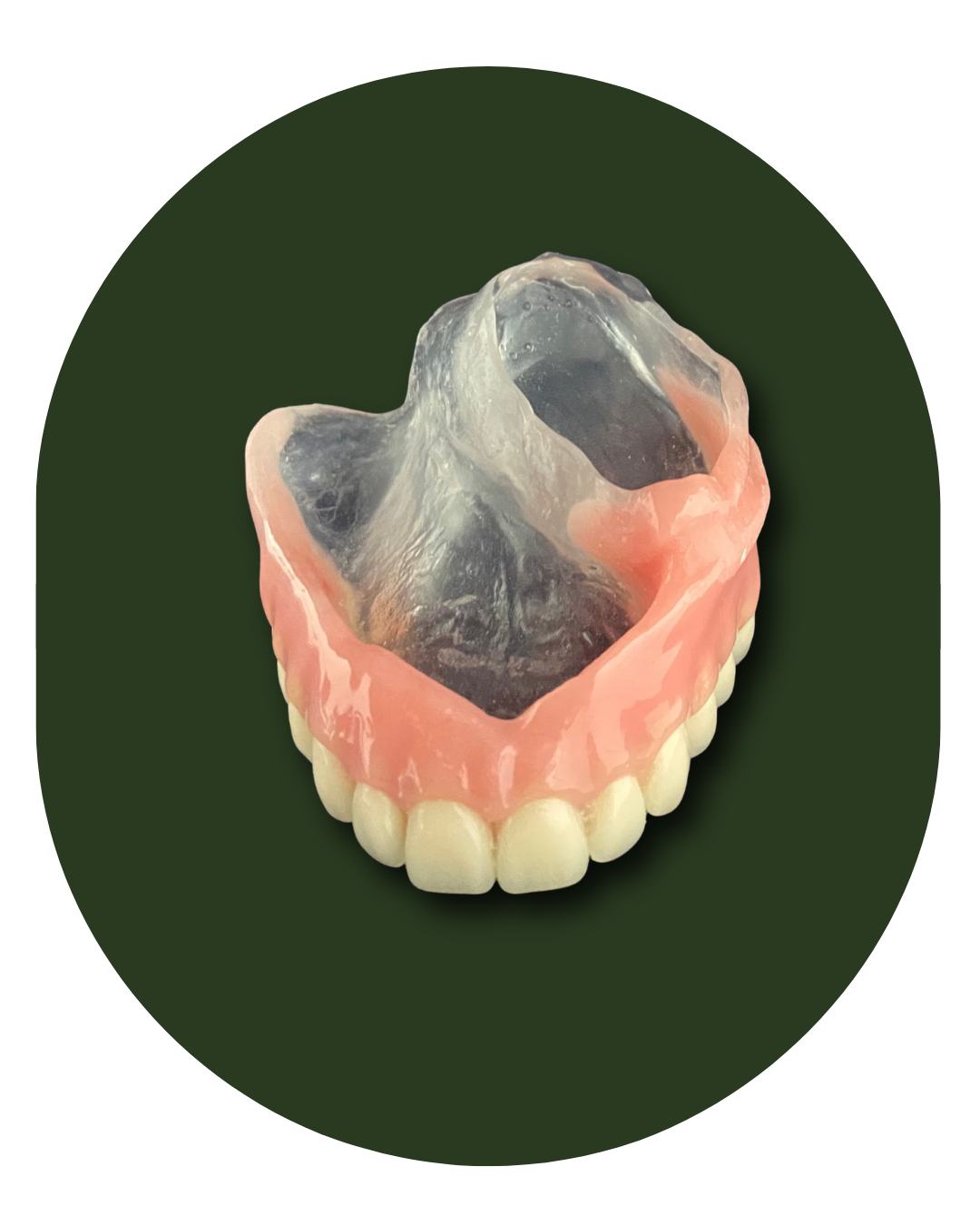 protese bucomaxilofacial, intra oral, Obturadora, Prótese para grandes perdas de maxila ou mandíbula, Rebaixadora de palato, Obturadora Imediata, Óculo Palpebral, Ocular, Nasal, Prótese de orelha, Prótese labial, Facial extensa, PROTETORES PARA RADIOTERAPIA