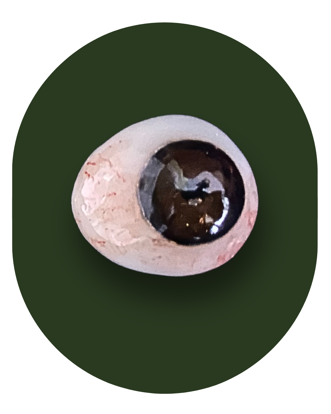 protese bucomaxilofacial, intra oral, Obturadora, Prótese para grandes perdas de maxila ou mandíbula, Rebaixadora de palato, Obturadora Imediata, Óculo Palpebral, Ocular, Nasal, Prótese de orelha, Prótese labial, Facial extensa, PROTETORES PARA RADIOTERAPIA