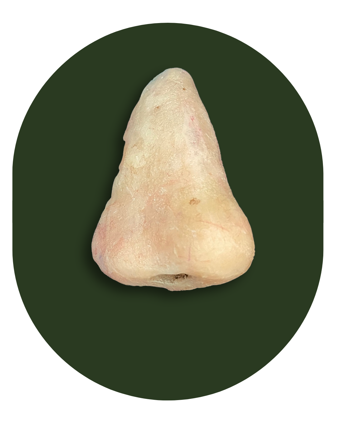 protese bucomaxilofacial, intra oral, Obturadora, Prótese para grandes perdas de maxila ou mandíbula, Rebaixadora de palato, Obturadora Imediata, Óculo Palpebral, Ocular, Nasal, Prótese de orelha, Prótese labial, Facial extensa, PROTETORES PARA RADIOTERAPIA